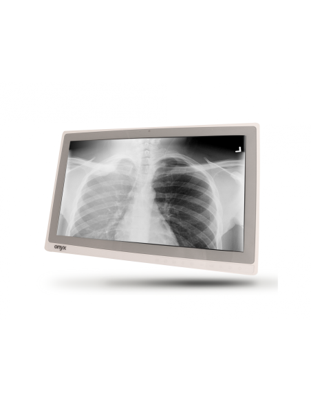 All-in-One компютър – ONYX – Healthcare ZEUS-248 – 24" FHD Touch – Core i7-6600U @ 2.6 GHz – 8192 MB DDR3